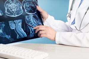 Doctor's hands holding an X-ray or MRI image showing a head and neck condition, highlighting the spinal cord, blood vessels, and brain. Neuro medicine and healthcare.